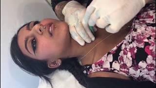 Neck Microdermal Procedure  Microdermal Implant Procedure  Madison Microdermal Piercings [upl. by Chernow]