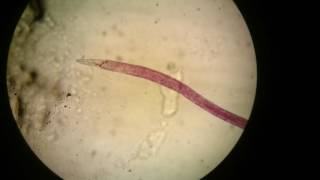 Adult female of Schistosoma haematobium [upl. by Celle131]