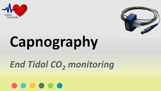 Capnography  End tidal CO2 monitoring  Little Criticos [upl. by Cloots97]