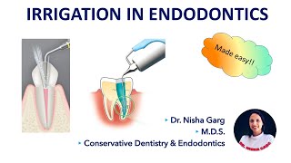 IRRIGATION IN ENDODONTICS  SODIUM HYPOCHLORITE  MCQs [upl. by Niall]