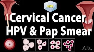 Cervical Cancer HPV and Pap Test Animation [upl. by Ardnaet]