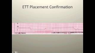 Capnography for EMS [upl. by Anoik609]