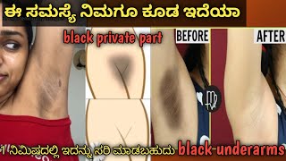 Home Remedy Tips UnderArms Whitening Rid Dark Spots amp Patches Skincare tip [upl. by Nairda]