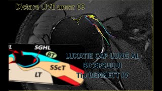 dictare live umar 09 ro [upl. by Aikrahs]