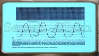 Basics of cardiac catheterization 2 [upl. by Reffinej]