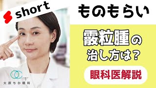 【ものもらい】痛くない「霰粒腫」の治し方は？sorts [upl. by Fagin638]