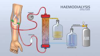 HAEMODIALYSIS DIALYZER [upl. by Raimundo655]