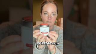 Is This Crème the Solution for Dry Eczema skin [upl. by Nuawed]