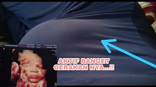 Gerak aktif janin usia 34 minggu  usia 8 Bulan  NIKMATNYA jadi seorang ibu [upl. by Selmore]