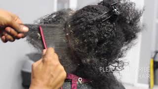 Picking BIG scalp flakes Psoriasis and Dermatitis SEW IN WEAVE REMOVAL [upl. by Eiliah]