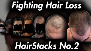 Reversing Hair Loss and Fixing Mental Health HairStacks No2 [upl. by Feodore]