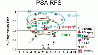 Permanent Seed Brachytherapy for Prostate Cancer Long Term Results [upl. by Rozina]