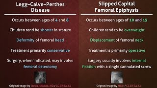 Legg–Calve–Perthes Disease vs Slipped Capital Femoral Epiphysis [upl. by Ynna]