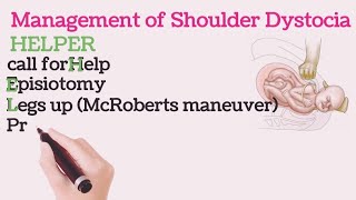 Management Of Shoulder Dystocia [upl. by Zohara748]