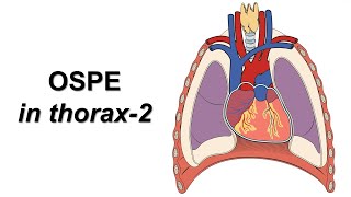 OSPE in thorax part2 Prof Dr Md Ashfaqur Rahman [upl. by Hayyim]