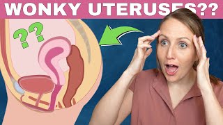 What is a retroverted uterus [upl. by Hnaht]