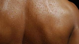 Embarrassing Problem  Excess Sweating  Ayurveda  Dr Sumita Prajapati [upl. by Matrona]