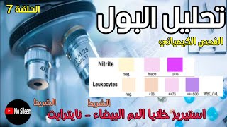 Urinalysis 7 Chemical ex Leukocyte esterase  Nitrite [upl. by Danielson308]