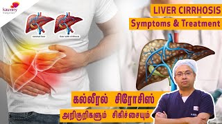 Liver cirrhosis – symptoms and Treatment  கல்லீரல் சிரோசிஸ் – அறிகுறிகள் மற்றும் சிகிச்சைகள் [upl. by Werbel]