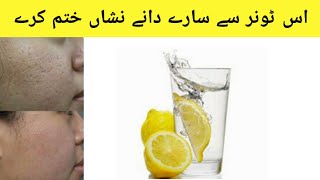 Natural toner  acne amp scars remove  in urdu  hindi  FariaJaved [upl. by Asilrahc]