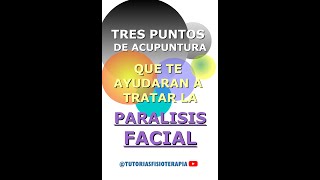 TRATE la PARALISIS FACIAL con estos TRES 3 Maravillosos puntos de acupuntura fisioterapia [upl. by Oralla]