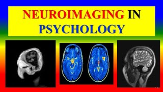 NEUROIMAGING METHOD IN PSYCHOLOGY   Applied psychology for Nursing [upl. by Roze55]