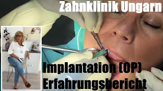 Zahnbehandlung in Ungarn Erfahrungsbericht die OP Implantation Patientin schildert den Ablauf [upl. by Fink]