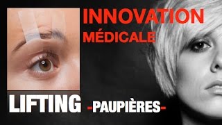 LIFTING DES PAUPIÈRES sans cicatrice  PlexR® en vidéo avantaprès [upl. by Dey]