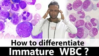 How to differentiate immature WBC [upl. by Madian]