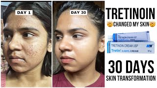 30 days skin tansformation with tretinoin  How to use tretinoin without side effectspurging [upl. by Aylward]