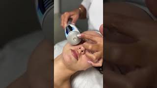 Endosphere Facial Therapy buckinghampalace london [upl. by Maxima479]