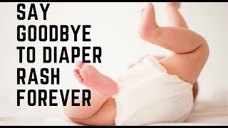 DIAPER RASH PREVENTION  3 tips to a healthy baby bottom [upl. by Gnidleif252]