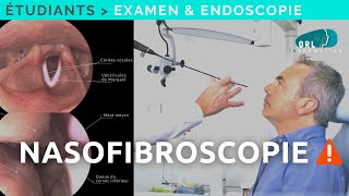 Comment réaliser une Nasofibroscopie  Formation étudiant ORL [upl. by Esinaej]