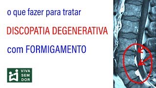 O que fazer para tratar discopatia degenerativa com formigamento [upl. by Adnalra]