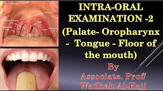 11Intraoral examination2PalateOropharynx TongueDr Wadhah Oral diagnosis lecturesدوضاح الحاج [upl. by Gnouh323]