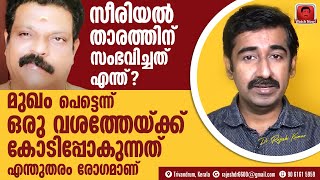 മുഖം പെട്ടെന്ന് ഒരുവശത്തേയ്ക്ക് കോടിപ്പോകുന്നത് എന്തുകൊണ്ട്സീരിയൽ താരത്തിന് ഉണ്ടായ ഈ രോഗം എന്താണ് [upl. by Alleinnad]