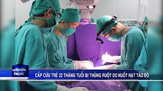 Cấp cứu trẻ 22 tháng tuổi bị thủng ruột do nuốt hạt táo đỏ [upl. by Charpentier]