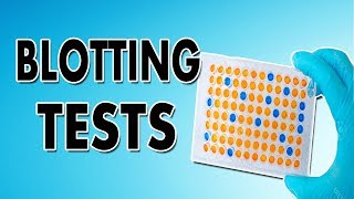 Blotting Techniques Western Blot Southern Blot and Northern Blot [upl. by Yleme79]