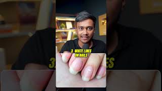 Check Your NAILS NOW shortsindia millionairemindset viralvideo [upl. by Attelrahs]