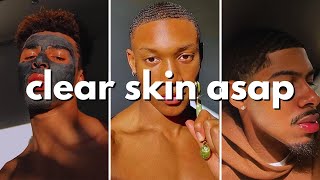 how to get clear skin for guys asap no bs guide [upl. by Carol-Jean]