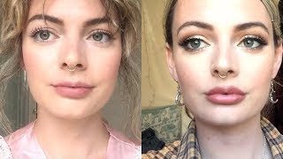 05ML LIP FILLERS  BEFORE AND AFTER  ONE WEEK VLOG 💉 [upl. by Michelsen]