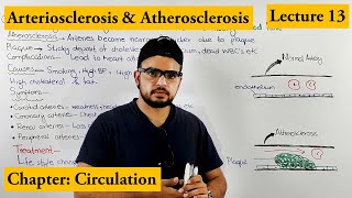 Arteriosclerosis amp Atherosclerosis CardioVascularDisorder  Chapter circulation Video  13 [upl. by Ettevets]