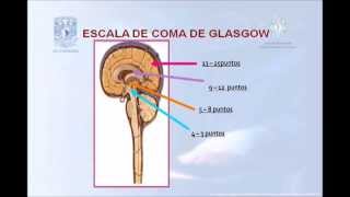 Escala de Coma de Glasgow en Traumatismo Craneoencefálico [upl. by Gough]