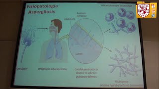 Microbiología Micosis Sistémicas [upl. by Eustazio]