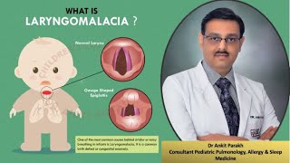 Laryngomalcia Stridor Symptoms Diagnosis amp Treatment I Dr Ankit Parakh Child Pulmonologist [upl. by Claudie]