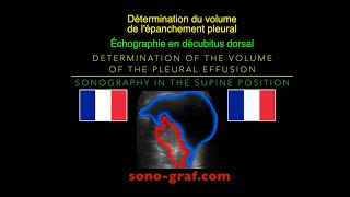 Échographie  Détermination du volume de lépanchement pleural en décubitus dorsal [upl. by Yriek722]