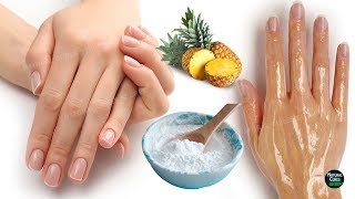 How To Remove Wrinkles From Hands Naturally in 2 Days [upl. by Foskett]