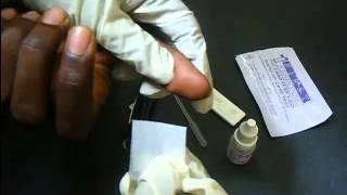 HIV Antibody Test Using A Rapid HIV Card [upl. by Zedecrem]