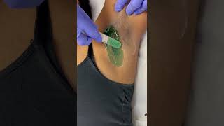 Professional underarm video waxing waxingexpert [upl. by Nikos509]