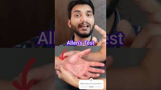 Allens Test shorts [upl. by Durant]